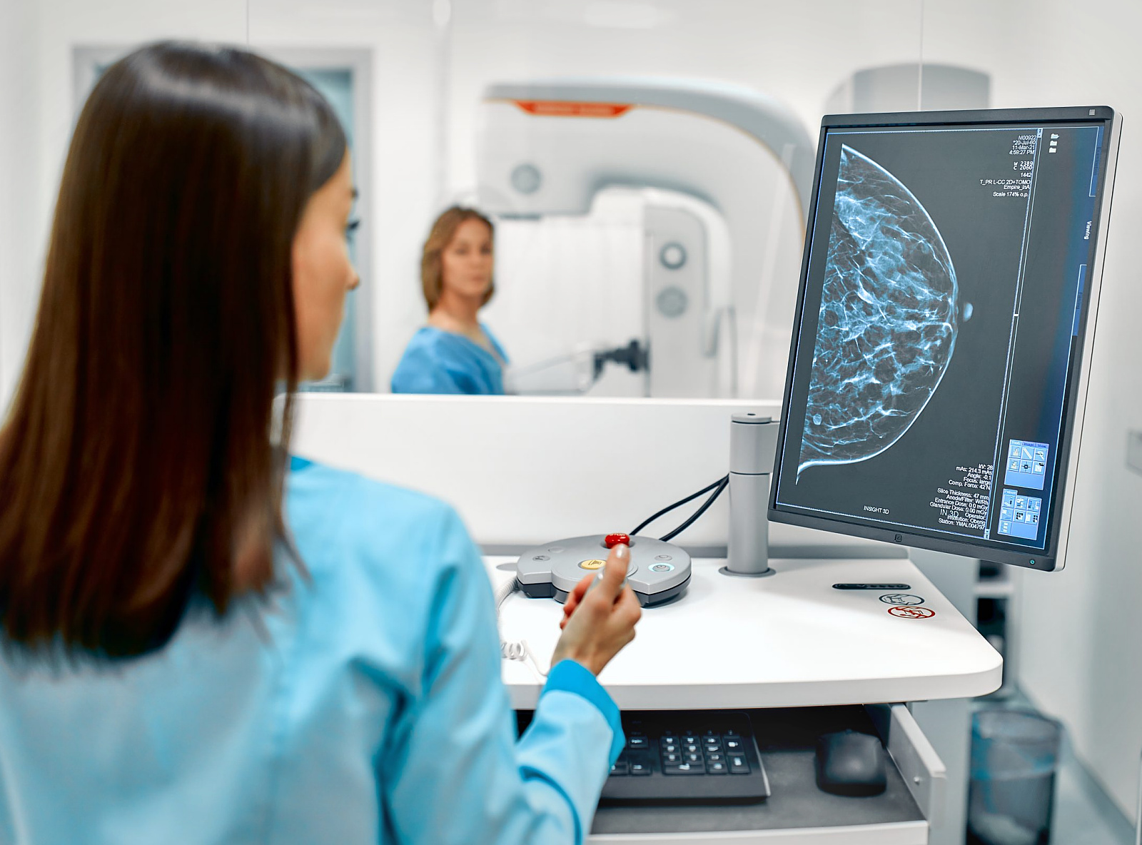 Mammográfiás vizsgálat